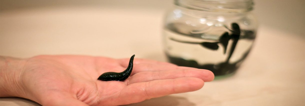 Гирудотерапия - Центр Технологий Здоровья