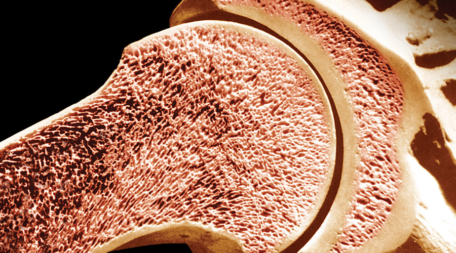 Костная ткань - cetez