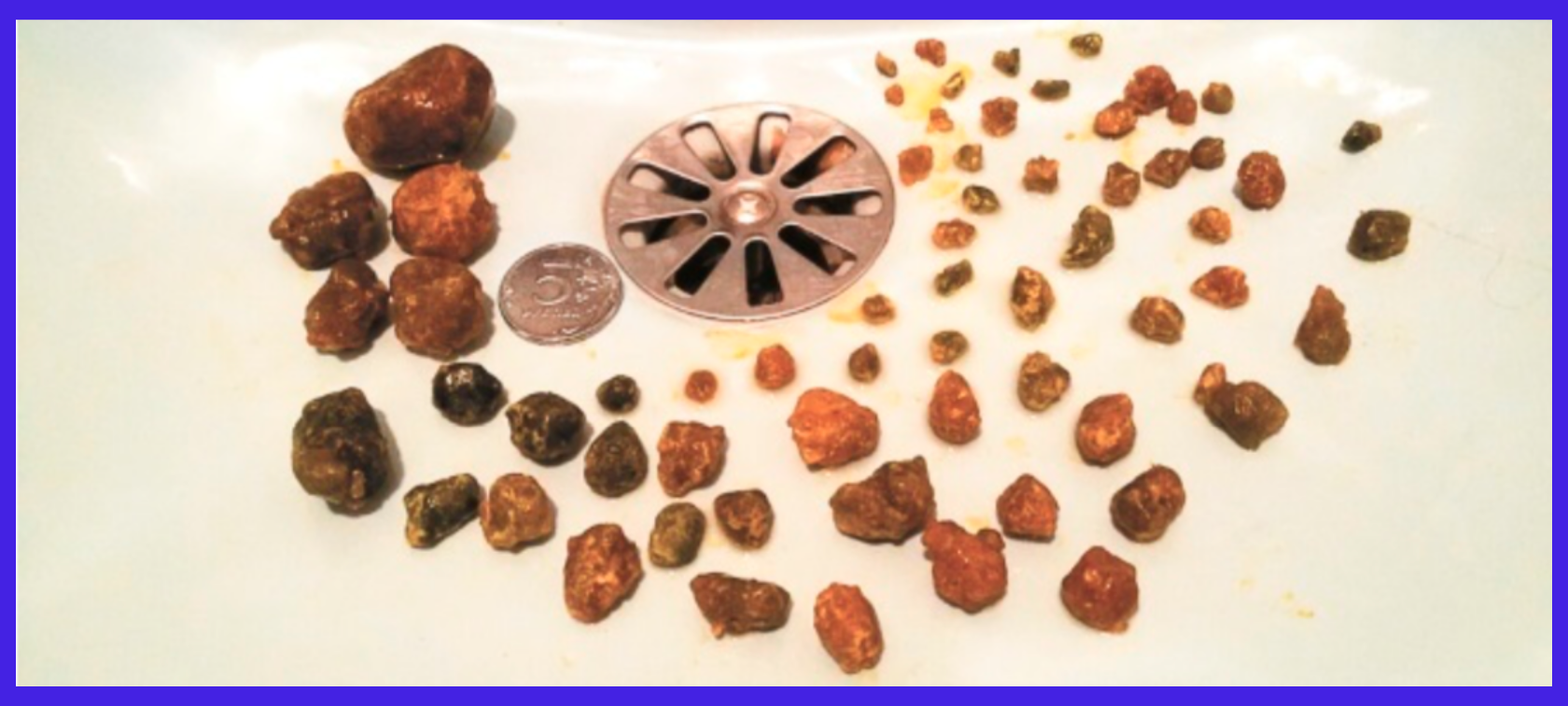 Гимнастика Савотникова - Центр Технологий Здоровья