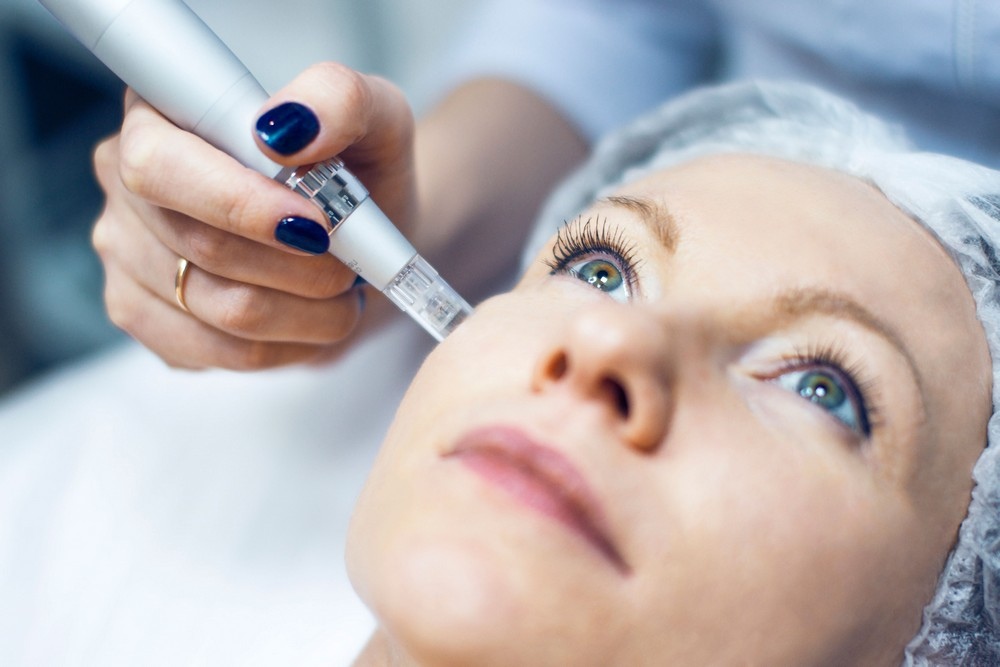 Мезотерапия