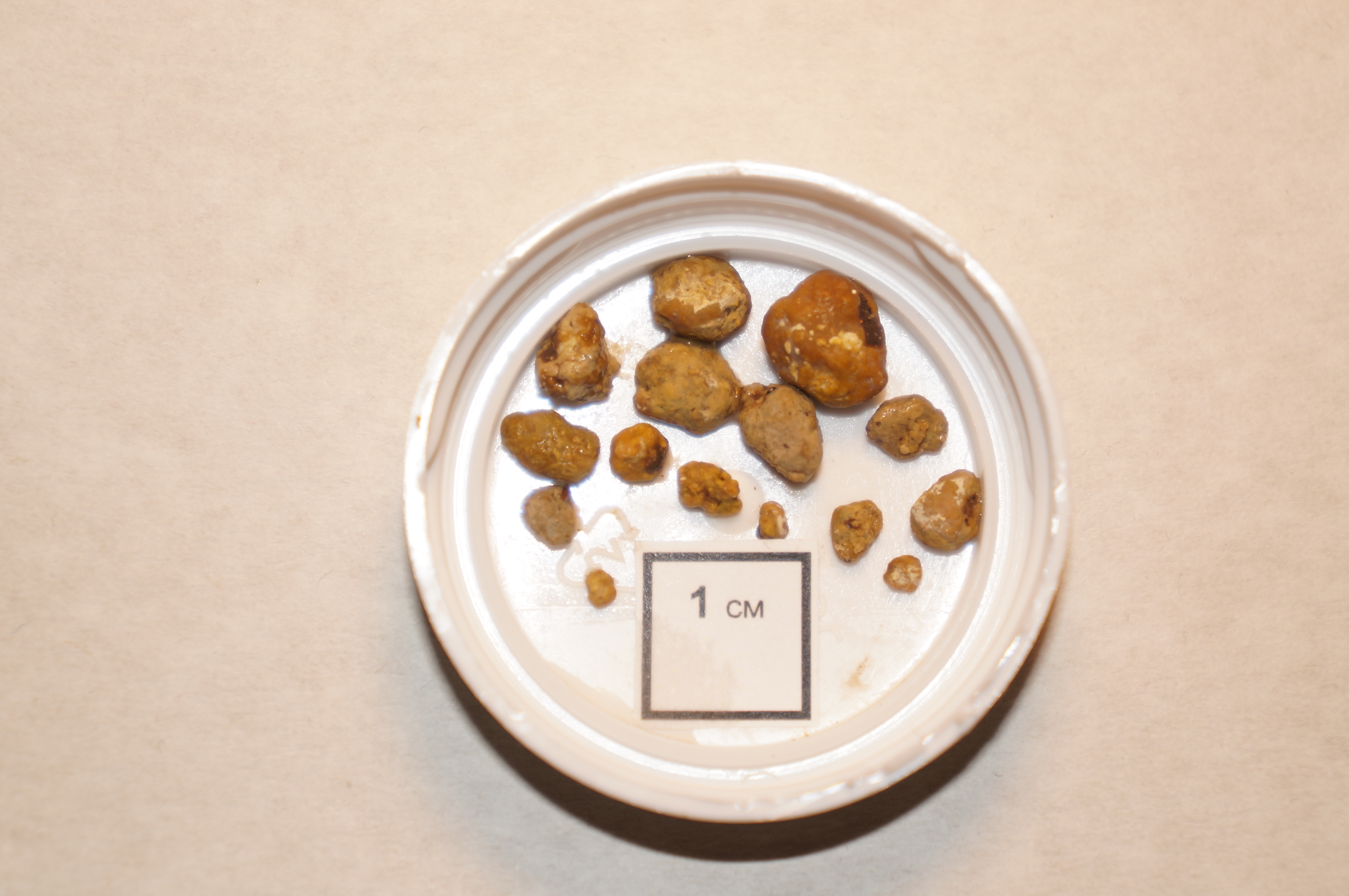 Гимнастика Савотникова - Центр Технологий Здоровья